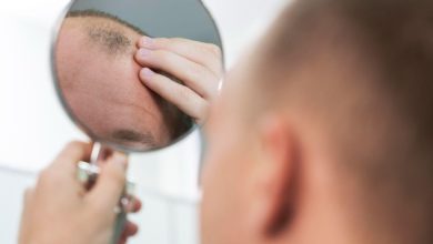 عوامل موثر بر ریزش مو را بشناسید