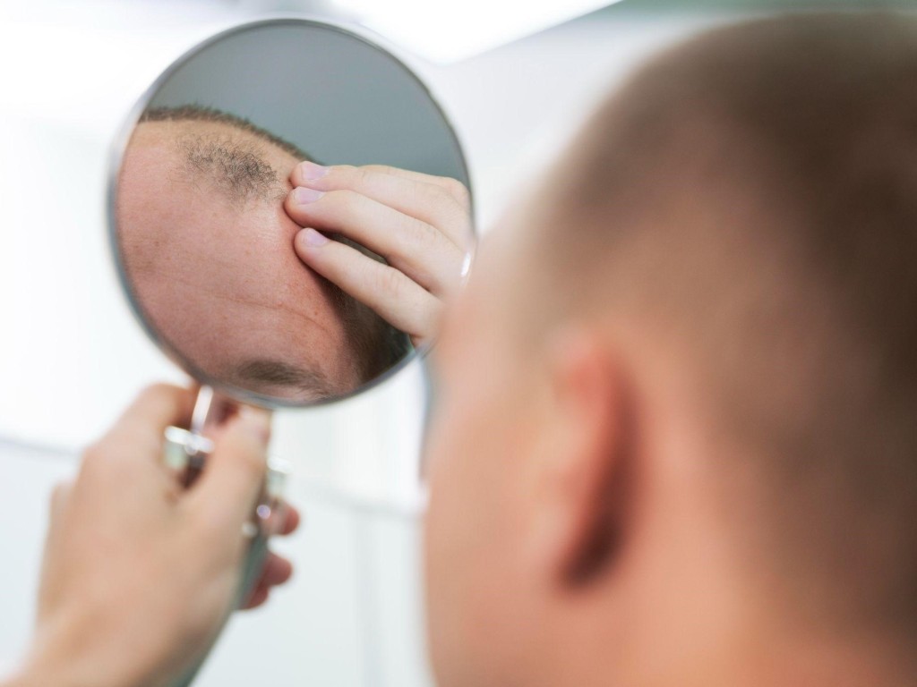 عوامل موثر بر ریزش مو را بشناسید