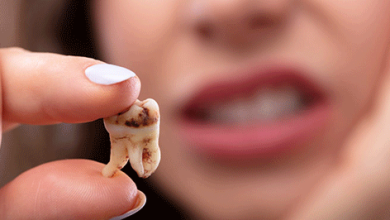 ارزان‌ترین راه نجات دندان‌ها از پوسیدگی