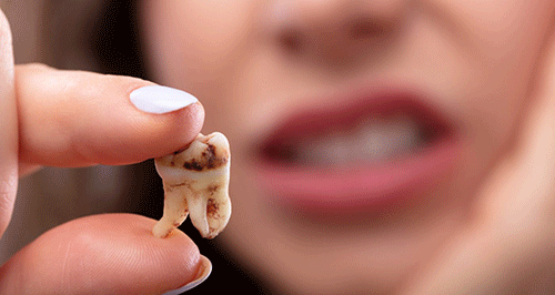 ارزان‌ترین راه نجات دندان‌ها از پوسیدگی