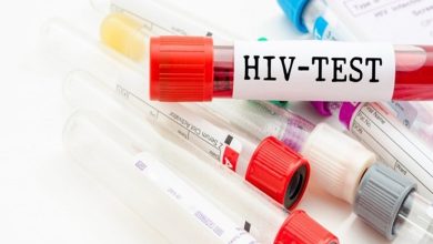 آمار مبتلایان به ایدز : هشدار درباره تغییر الگوی انتقال HIV