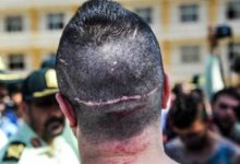 تعرفه تیراندازی، قمه‌کشی و قطع عضو