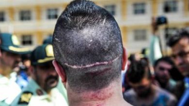 تعرفه تیراندازی، قمه‌کشی و قطع عضو