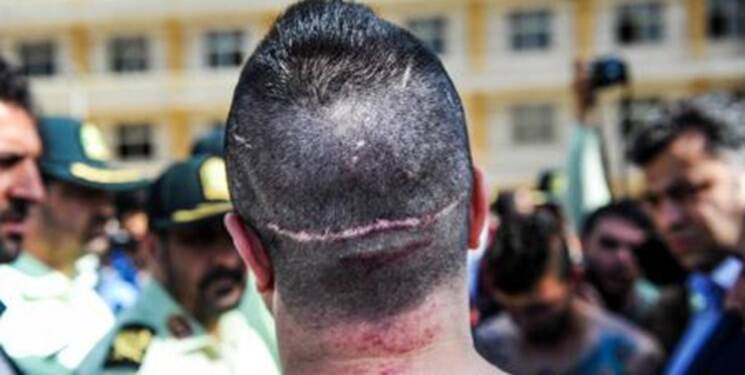 تعرفه تیراندازی، قمه‌کشی و قطع عضو