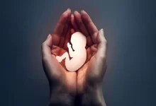 سقط جنین غیرمجاز