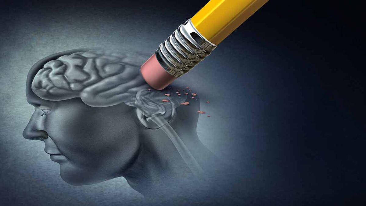 سن ابتلا به آلزایمر در ایران کاهش یافته است