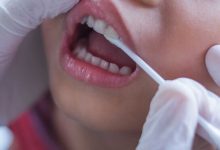 رژیم مدیترانه‌ای: کلید سلامت لثه‌ها و کاهش التهاب در بدن