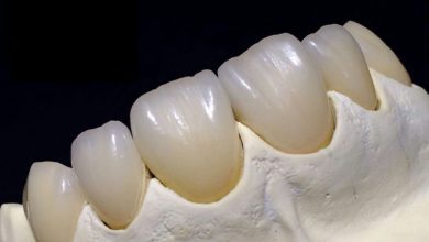 نانوزیرکونیا دندانی