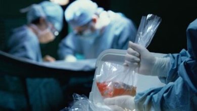 مرگ مغزی و اهدای عضو