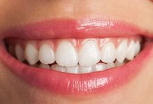 ژل جدید ناتینگهام