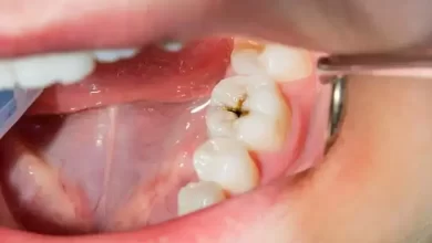 خطر سکته مغزی