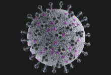 افزایش شیوع آنفلوآنزا همزمان با ظهور سوش XFG کرونا؛ دو تهدید تنفسی فعلی