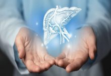 کبد چرب، قاتل بی‌صدا؛ هشدار فوق تخصص گوارش و کبد