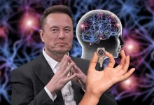 ایلان ماسک قفل را شکست؛ ایمپلنت مغزی نورالینک وارد تولید انبوه شد