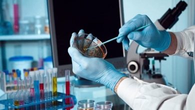 سازمان انتقال خون می تواند محور توسعه بانک سلول‌های بنیادی باشد