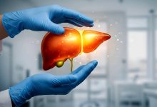 پنج هشدار روی صورت که از کبد چرب خبر می‌دهند