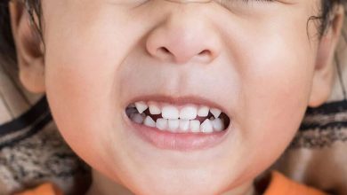 ۳ نشانه پنهان دندان‌قروچه که ممکن است از آن بی‌خبر باشید