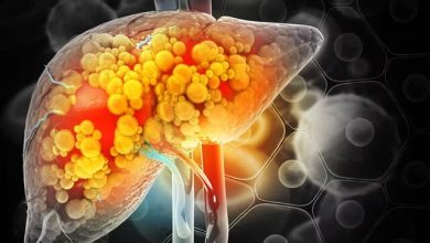 مصرف خودسرانه داروها از عوامل مهم آسیب به کبد