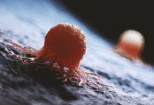 واقعیت کمتر گفته شده درباره سرطان