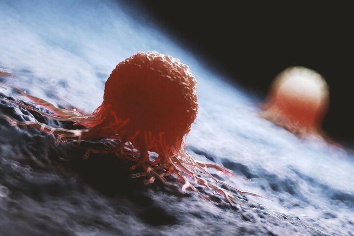 واقعیت کمتر گفته شده درباره سرطان