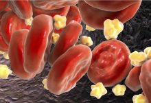 کلسترول بالا در جوانان؛ زنگ خطری که نباید نادیده گرفت