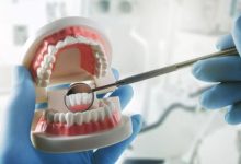 ۵ توصیه کلیدی برای بهبود مراقبت از دهان و دندان