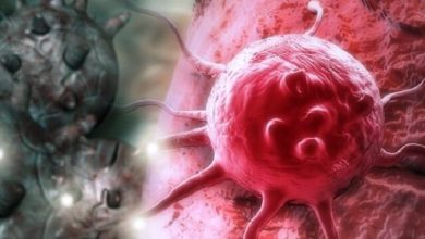 سامانه نانویی هوشمند تشخیص و درمان سرطان پروستات