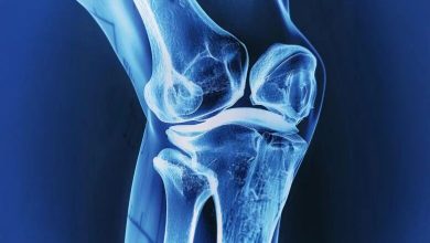 ایمپلنت استخوان