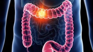 علت شیوع ۱۱ نوع سرطان در جوانان انگلیسی