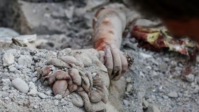 مصدومین جنگ