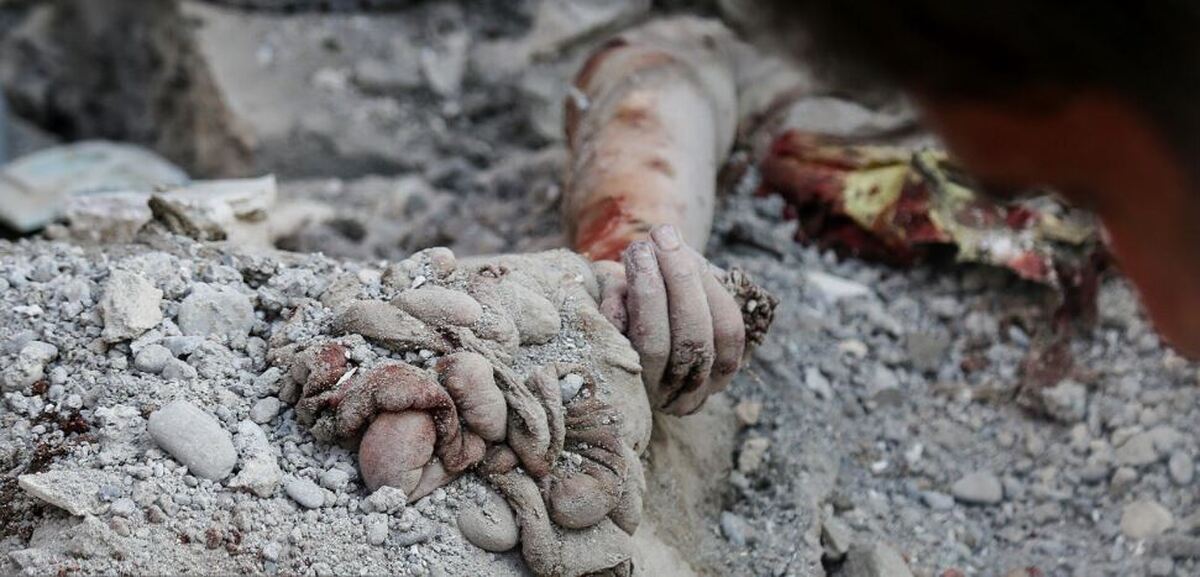 مصدومین جنگ