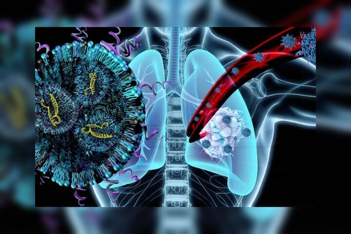 نانوذراتی که سرطان ریه و تحلیل عضلات را هم‌زمان درمان می‌کنند