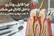 علل شکستن فایل اندو و تجهیزات عصب کشی در دندانپزشکی