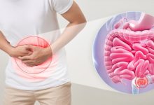 این رژیم غذایی ضد یبوست است