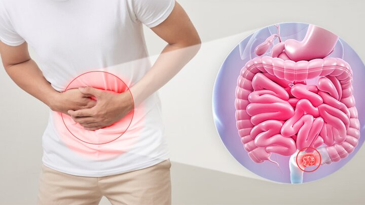 این رژیم غذایی ضد یبوست است