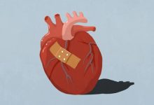 یک معیار جدید برای تشخیص سندرم قلب شکسته